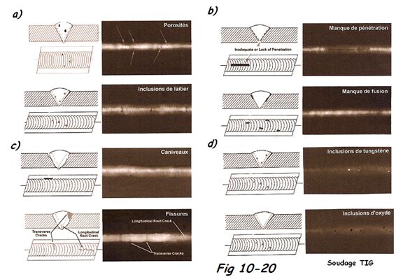 Discontinuités en Radiographie