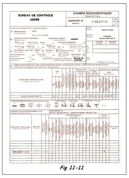 Exemple de Procès Verbal d’examen radiographique