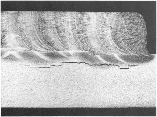 Arrachement lamellaire